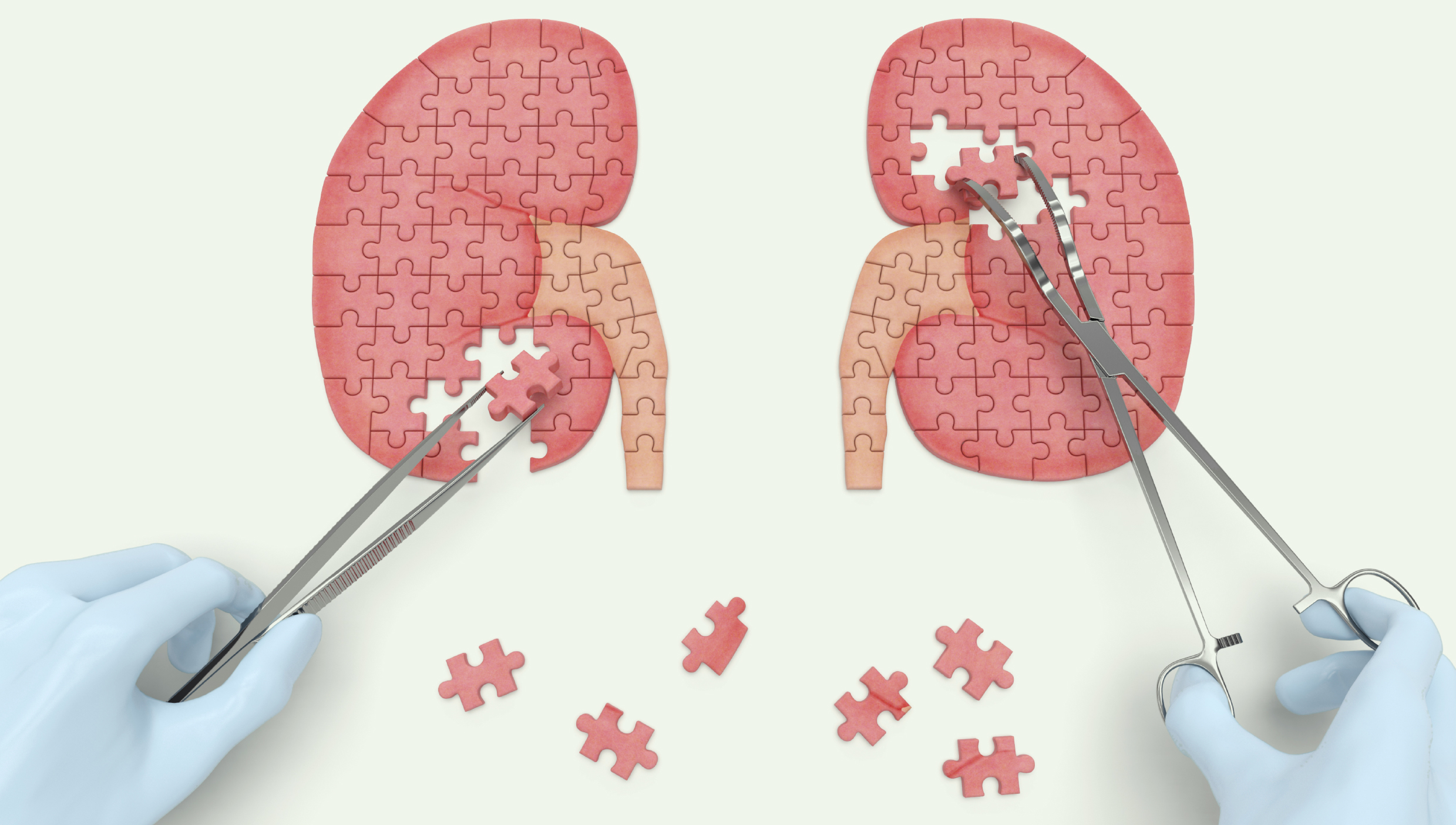 Conheça os cuidados necessários com o terçol – Rede FarmaGente